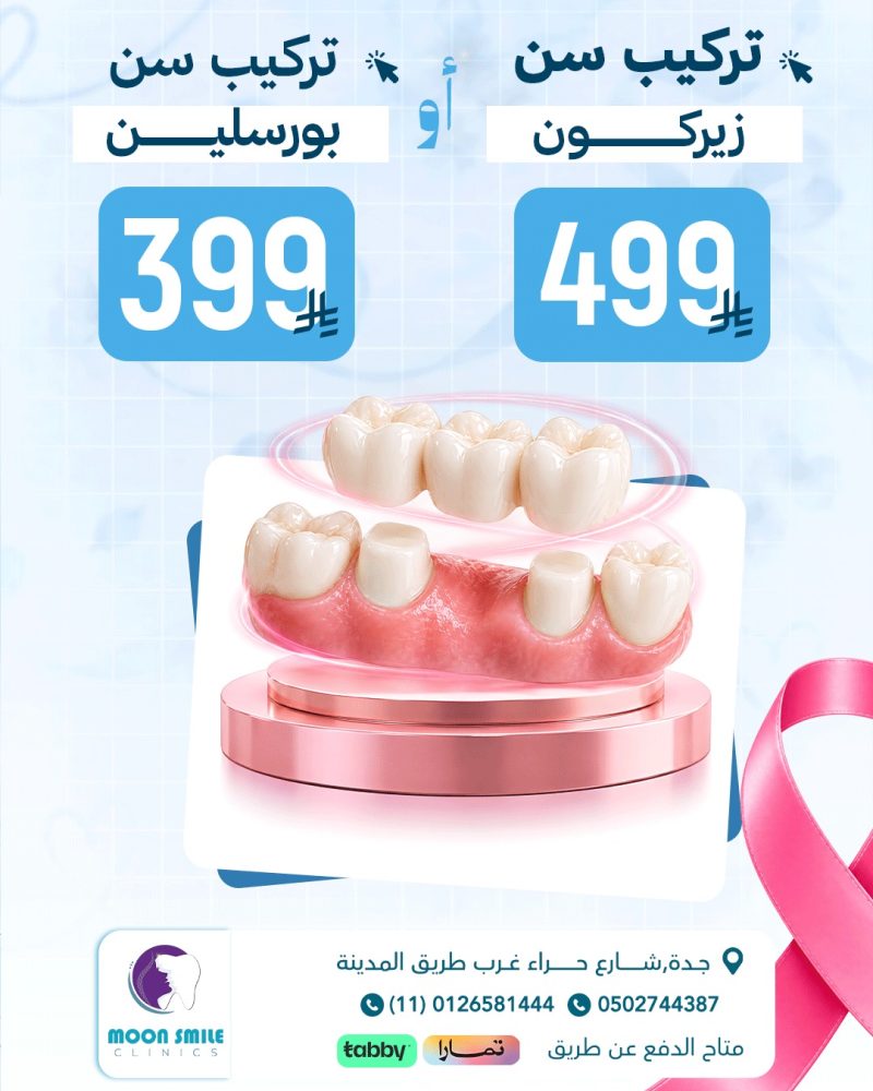 تركيب