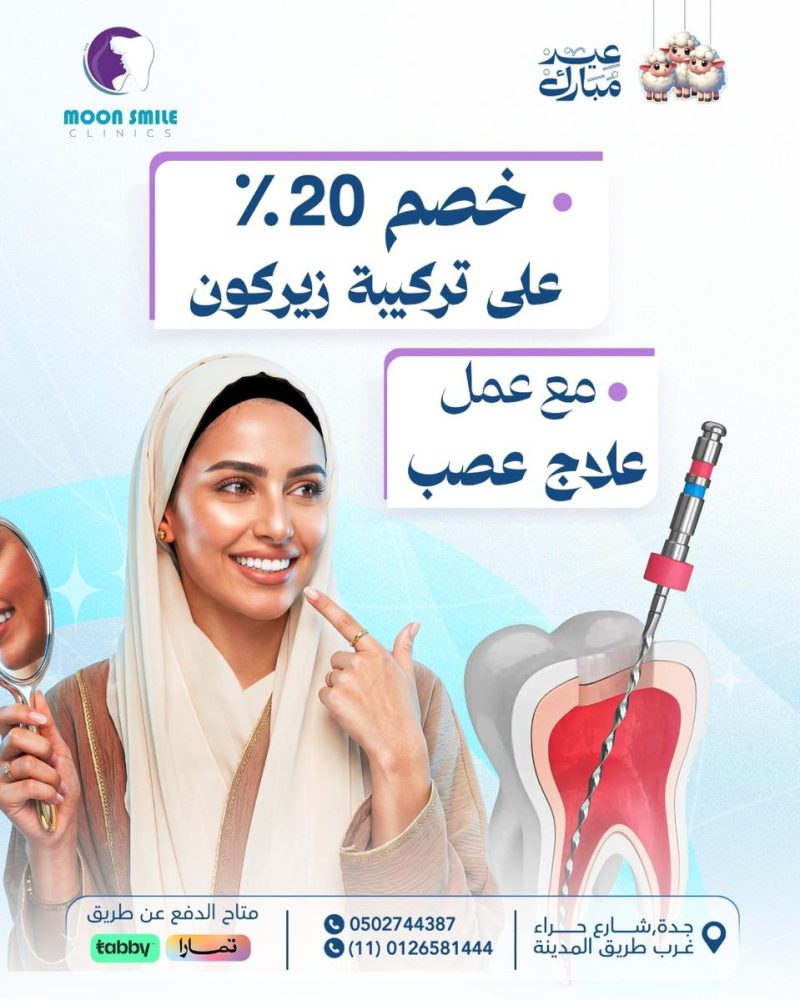 خصم 20