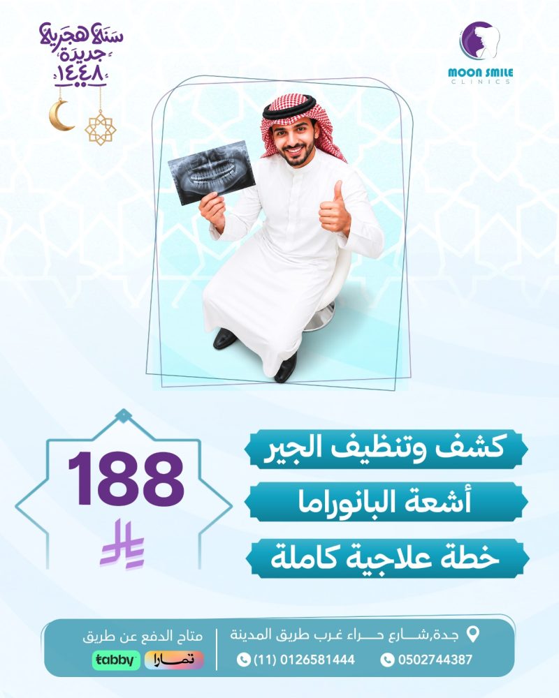 خطة