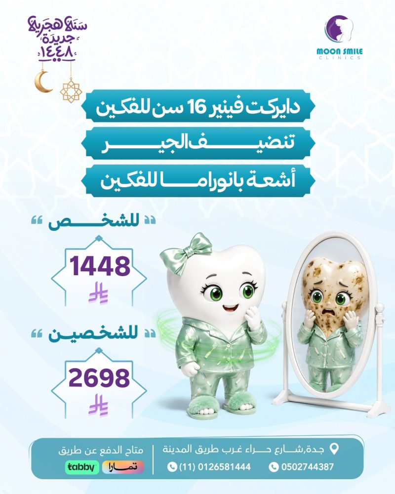 دايركت