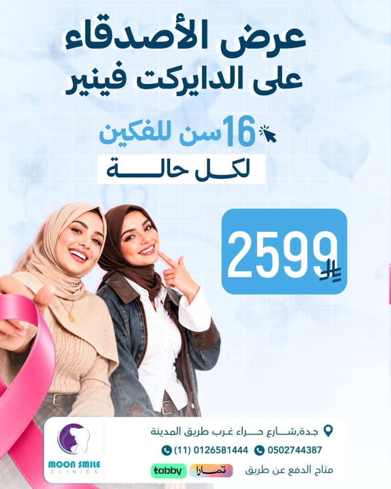 دايركت اقساط
