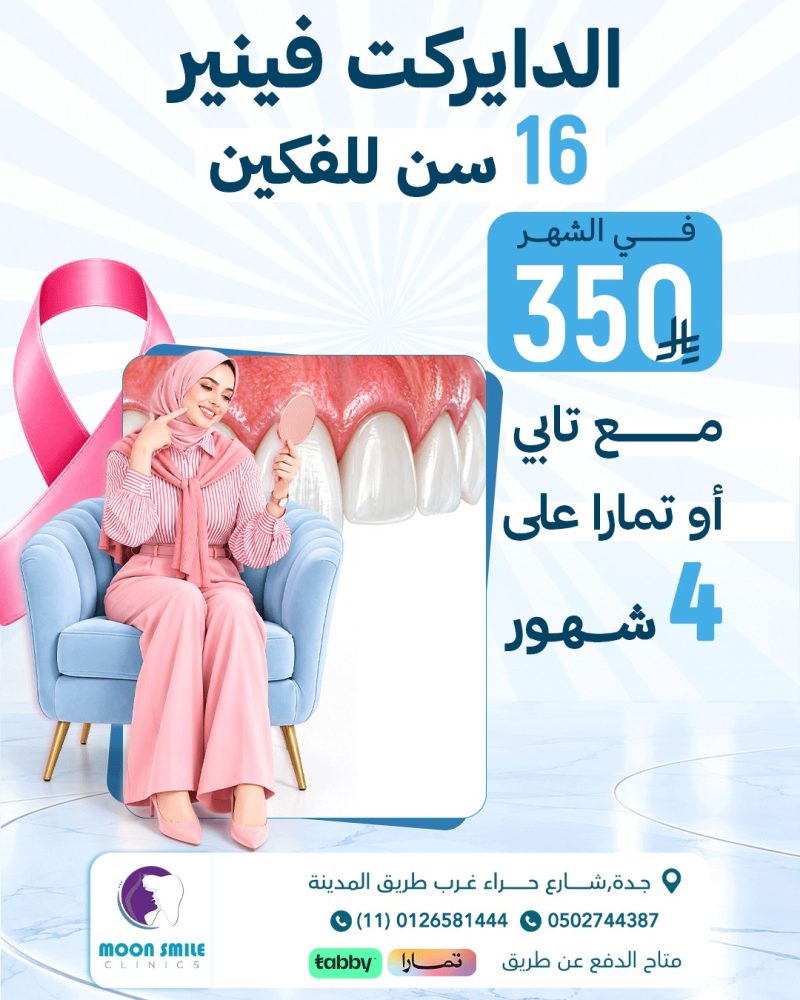 دايركت تقسيط