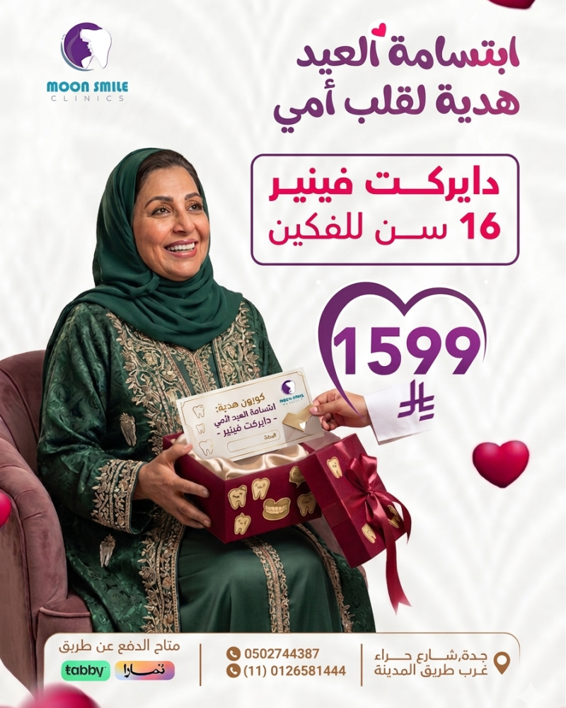 دايركت فينير
