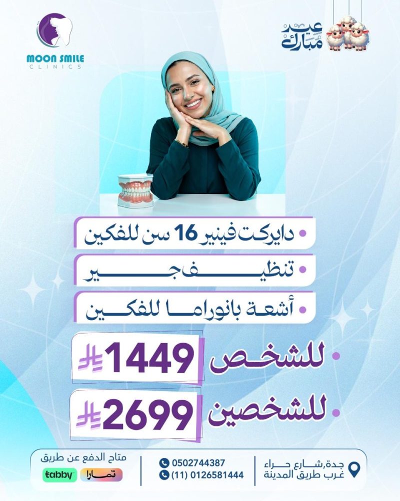 دايركت فينيرر