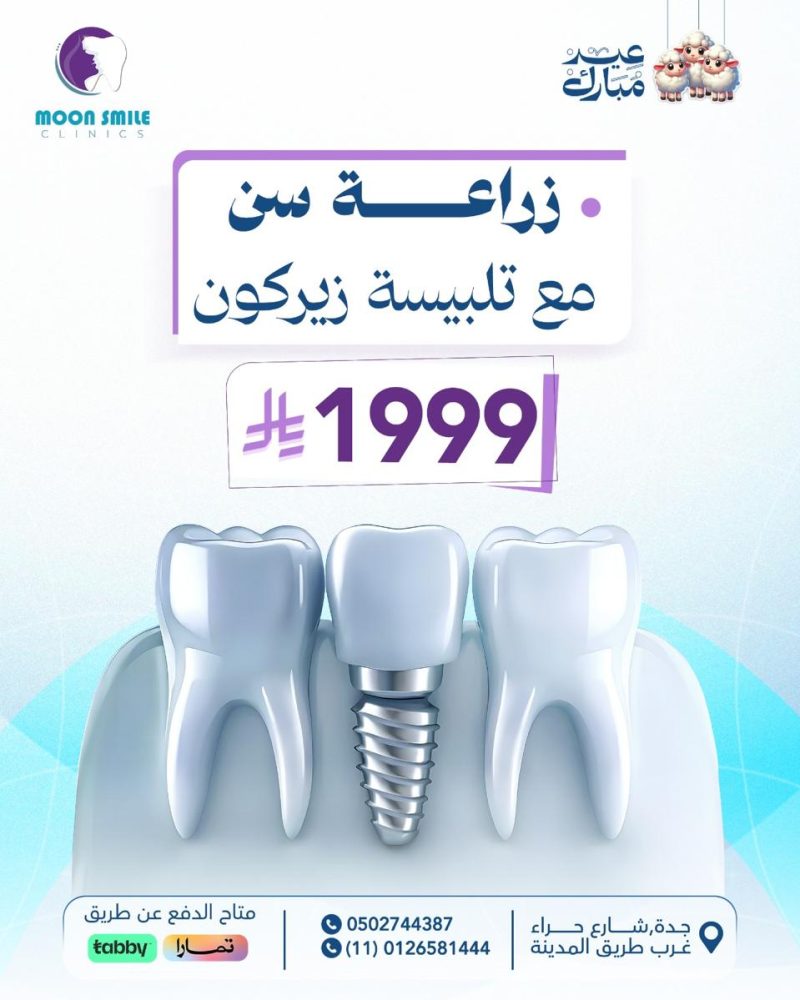 زراعة