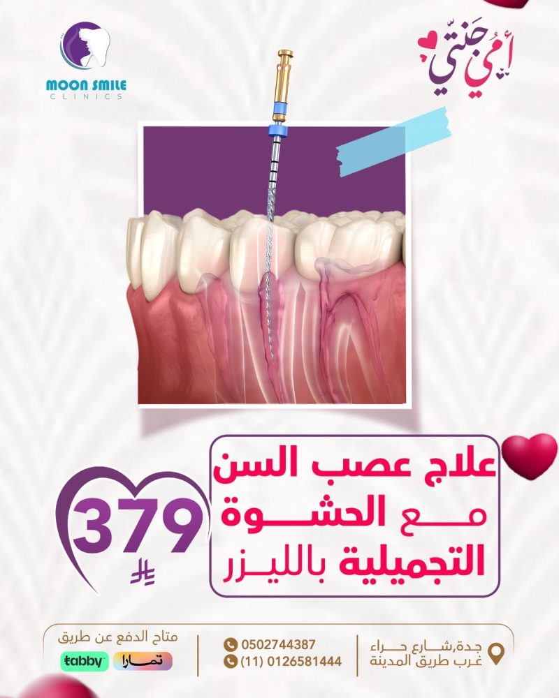 عصب