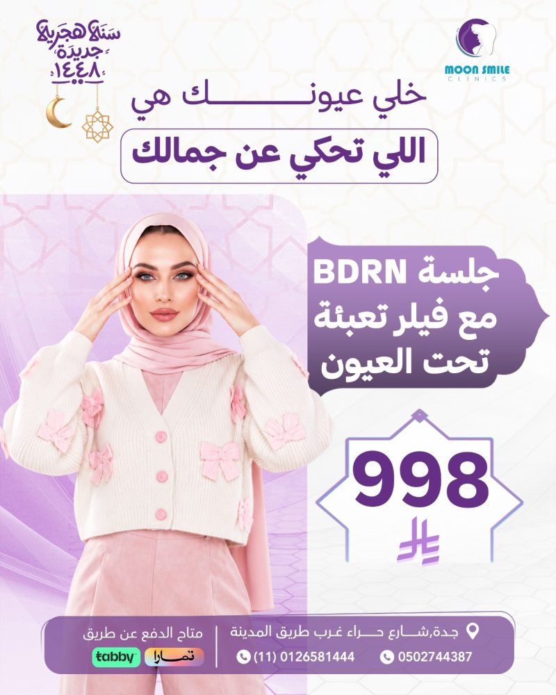 فيلر تحت عين