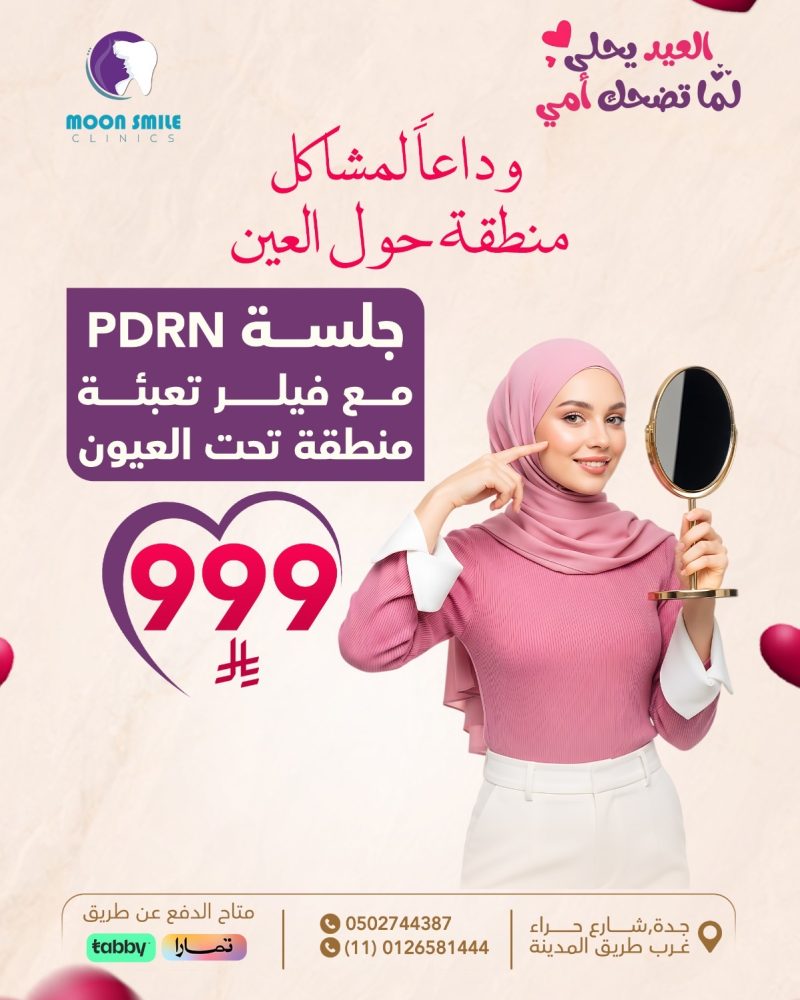 فيلر عيون
