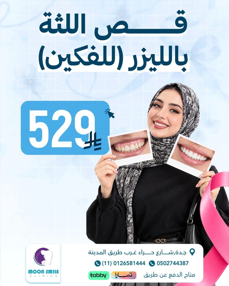 قص لثة