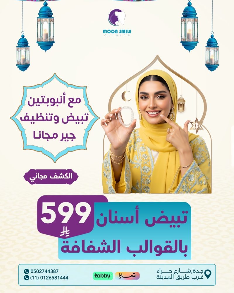 قوالب شفافة